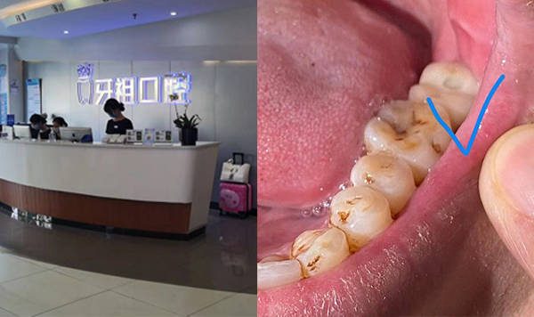 “黑牙医”——牙祖口腔遭遇记