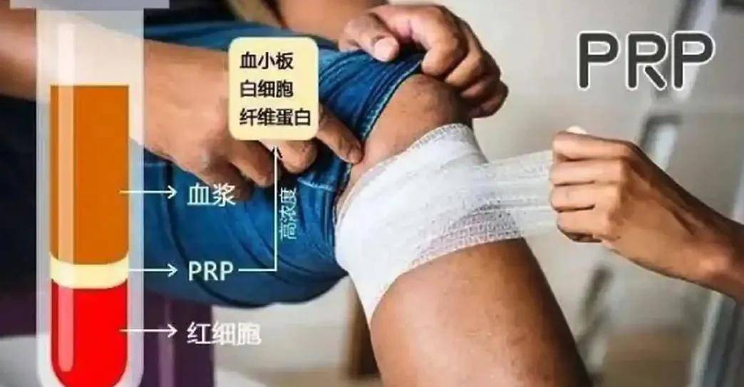 一针上万的高潮针预约爆满，性消费疯狂收割独立女性……