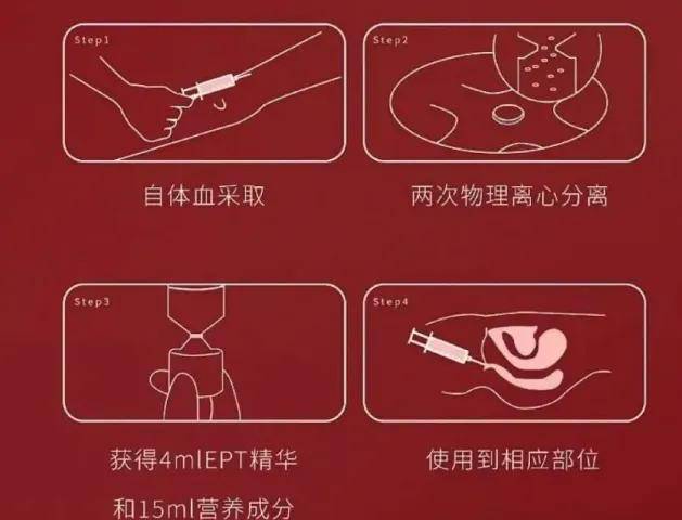 一针上万的高潮针预约爆满，性消费疯狂收割独立女性……