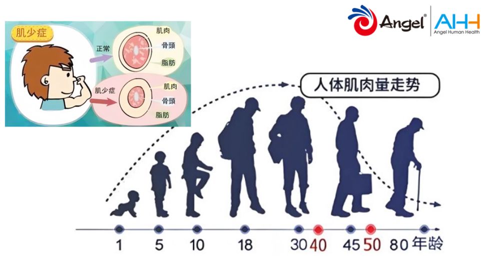蛋白供给的新质方案:一场从发酵罐里开始的产业革命 蛋白供给的新质方案:一场从发酵罐里开始的产业革命